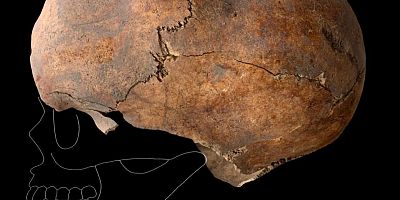 6 BİN YILLIK  ŞEKİLLENDİRÏLMİŞ KAFATASI BULUNDU
